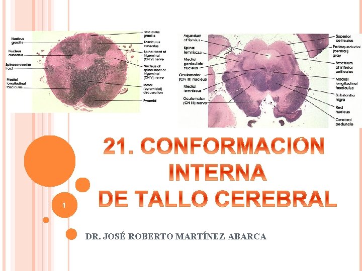 6/12/2021 1 DR. JOSÉ ROBERTO MARTÍNEZ ABARCA 