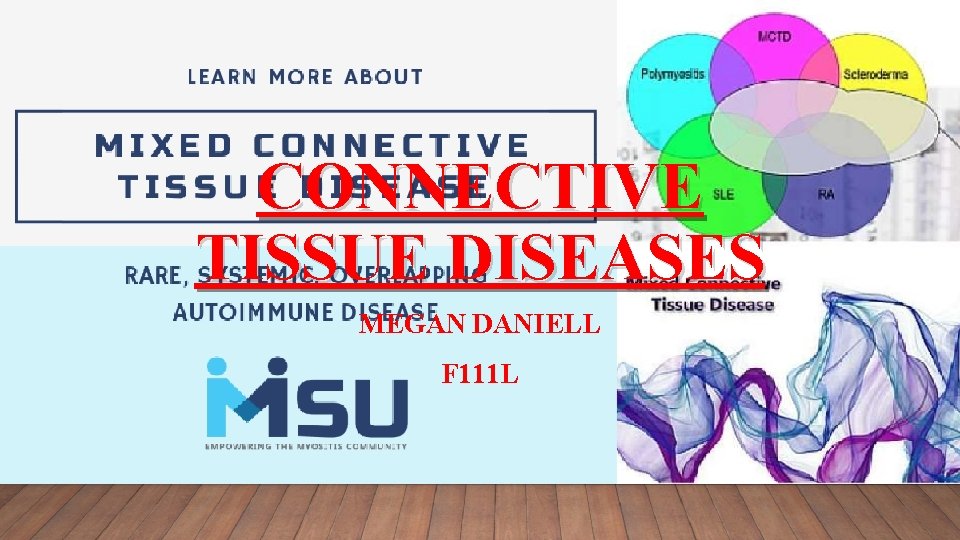 CONNECTIVE TISSUE DISEASES MEGAN DANIELL F 111 L 