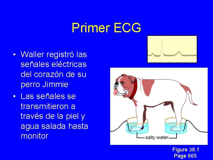 Primer ECG • Waller registró las señales eléctricas del corazón de su perro Jimmie