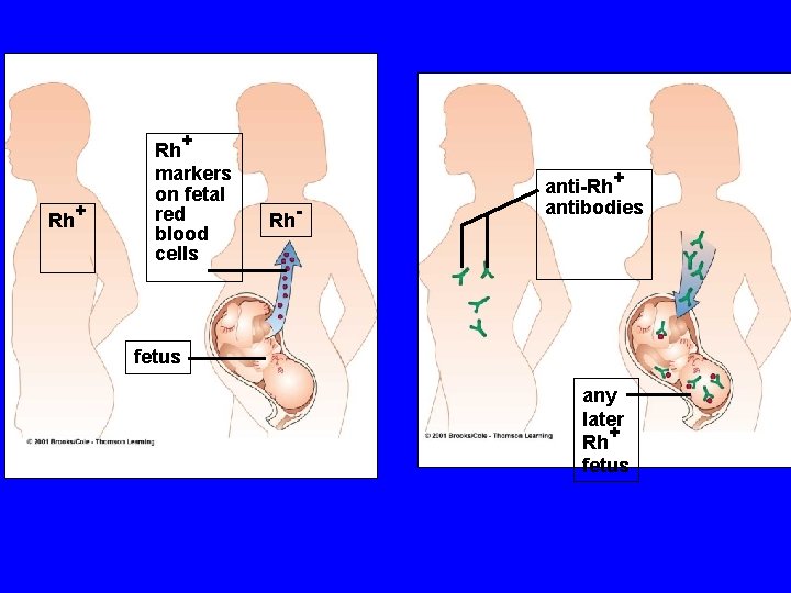 Rh+ markers on fetal red blood cells Rh- anti-Rh+ antibodies fetus any later Rh+