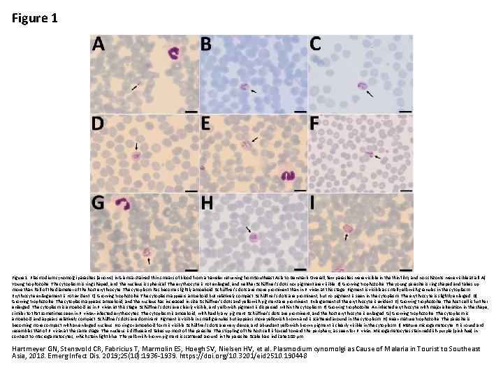 Figure 1. Plasmodium cynomolgi parasites (arrows) in Giemsa-stained thin smears of blood from a
