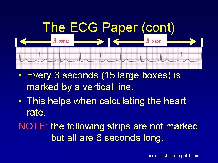 The ECG Paper (cont) 3 sec • Every 3 seconds (15 large boxes) is