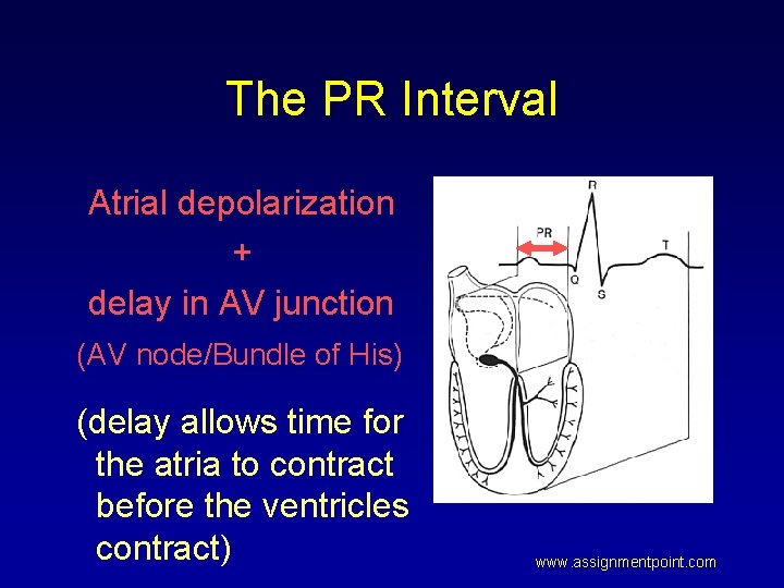 The PR Interval Atrial depolarization + delay in AV junction (AV node/Bundle of His)