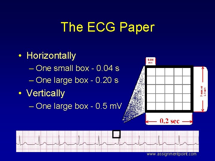 The ECG Paper • Horizontally – One small box - 0. 04 s –