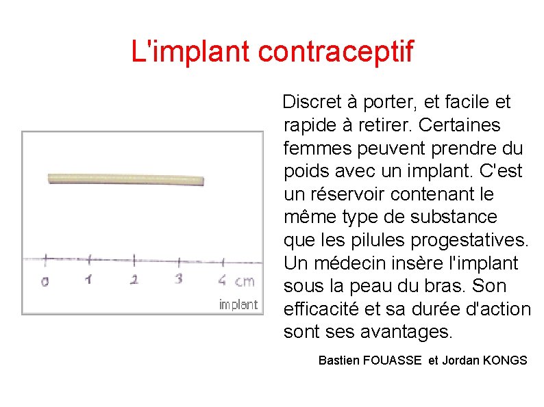 L'implant contraceptif Discret à porter, et facile et rapide à retirer. Certaines femmes peuvent L'implant contraceptif Discret à porter, et facile et rapide à retirer. Certaines femmes peuvent