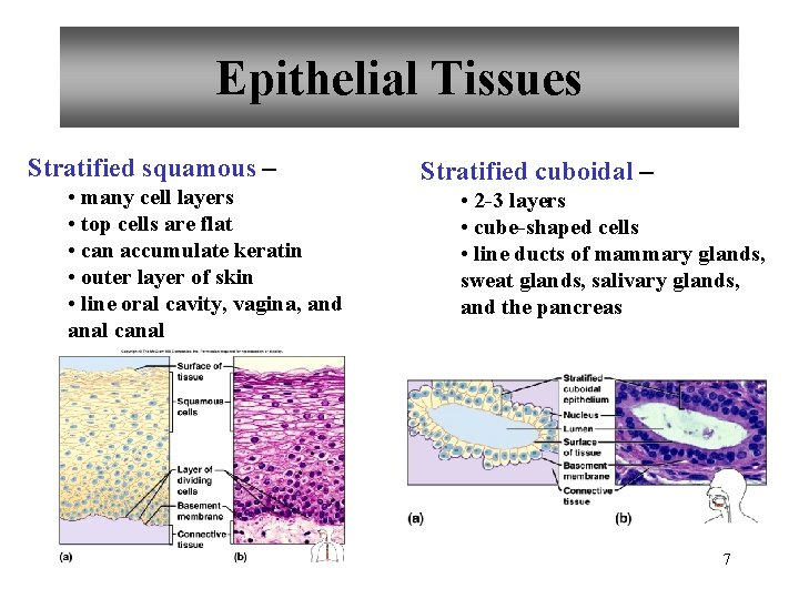 Epithelial Tissues Stratified squamous – • many cell layers • top cells are flat