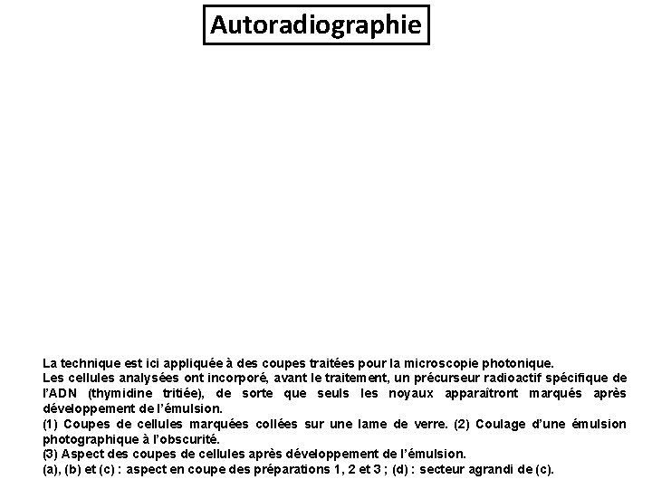 Autoradiographie La technique est ici appliquée à des coupes traitées pour la microscopie photonique.