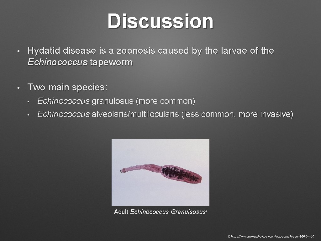 Discussion • Hydatid disease is a zoonosis caused by the larvae of the Echinococcus