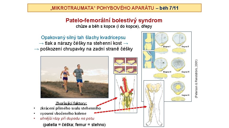 „MIKROTRAUMATA“ POHYBOVÉHO APARÁTU – běh 7/11 Patelo-femorální bolestivý syndrom chůze a běh s kopce