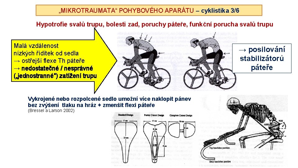 „MIKROTRAUMATA“ POHYBOVÉHO APARÁTU – cyklistika 3/6 Hypotrofie svalů trupu, bolesti zad, poruchy páteře, funkční