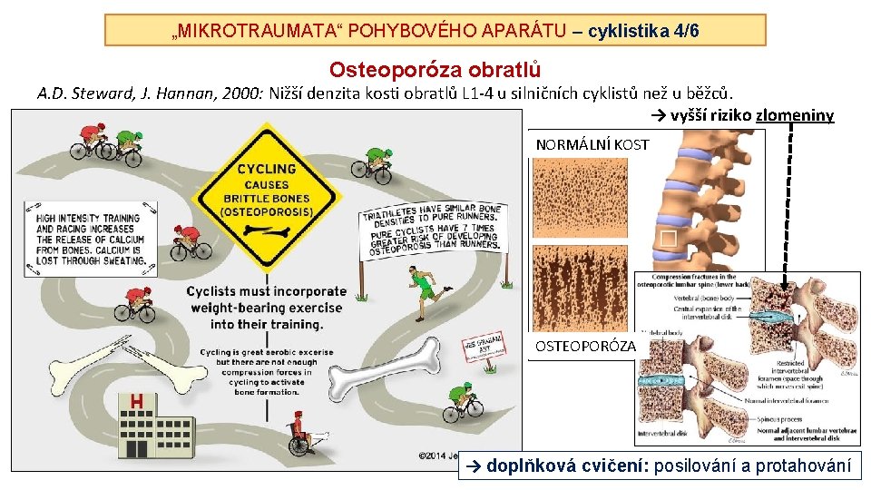 „MIKROTRAUMATA“ POHYBOVÉHO APARÁTU – cyklistika 4/6 Osteoporóza obratlů A. D. Steward, J. Hannan, 2000: