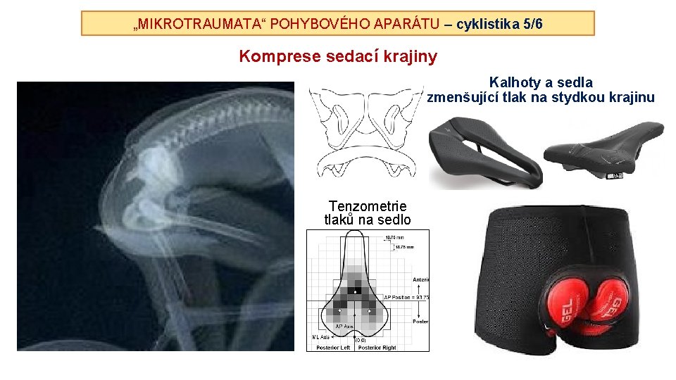 „MIKROTRAUMATA“ POHYBOVÉHO APARÁTU – cyklistika 5/6 Komprese sedací krajiny Kalhoty a sedla zmenšující tlak