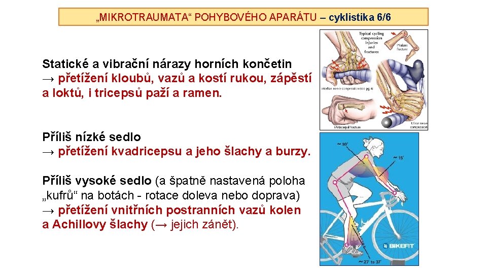 „MIKROTRAUMATA“ POHYBOVÉHO APARÁTU – cyklistika 6/6 Statické a vibrační nárazy horních končetin → přetížení