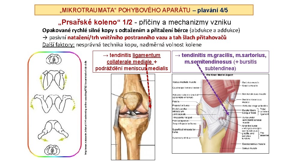 „MIKROTRAUMATA“ POHYBOVÉHO APARÁTU – plavání 4/5 „Prsařské koleno“ 1/2 - příčiny a mechanizmy vzniku