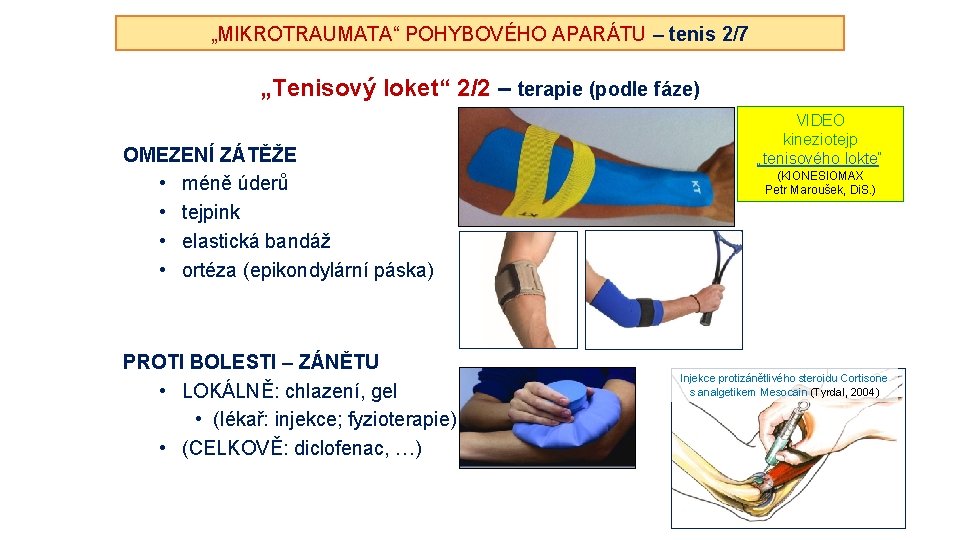 „MIKROTRAUMATA“ POHYBOVÉHO APARÁTU – tenis 2/7 „Tenisový loket“ 2/2 – terapie (podle fáze) OMEZENÍ