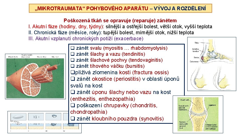 „MIKROTRAUMATA“ POHYBOVÉHO APARÁTU – VÝVOJ A ROZDĚLENÍ Poškozená tkáň se opravuje (reparuje) zánětem I.