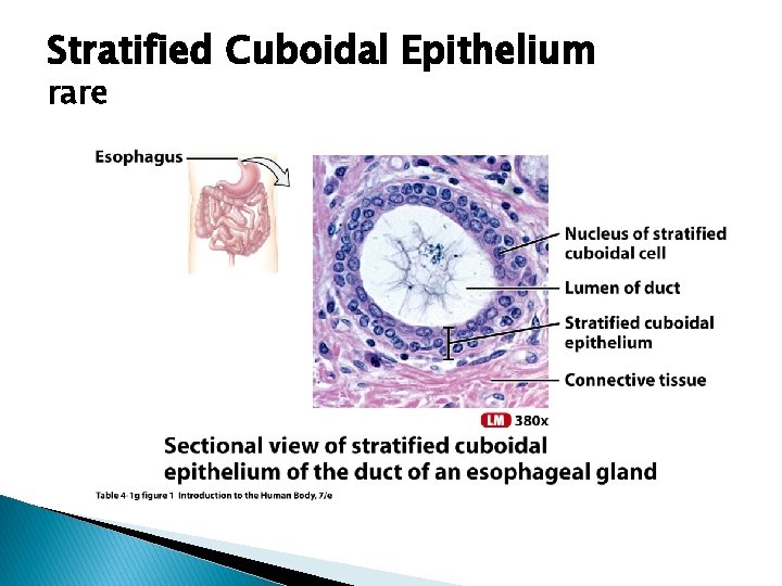 Stratified Cuboidal Epithelium rare 