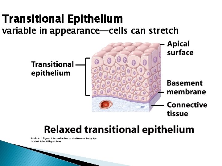 Transitional Epithelium variable in appearance—cells can stretch 