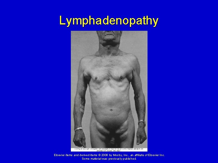 Lymphadenopathy Elsevier items and derived items © 2008 by Mosby, Inc. , an affiliate