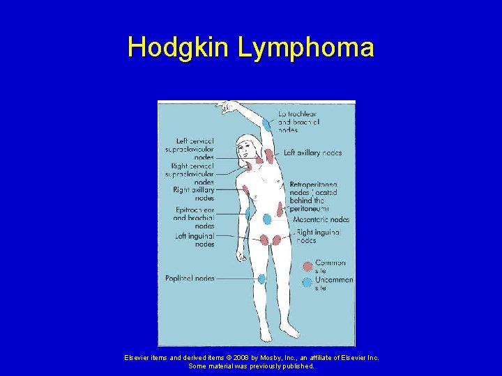 Hodgkin Lymphoma Elsevier items and derived items © 2008 by Mosby, Inc. , an