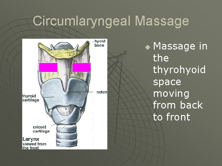 Circumlaryngeal Massage u Massage in the thyrohyoid space moving from back to front 