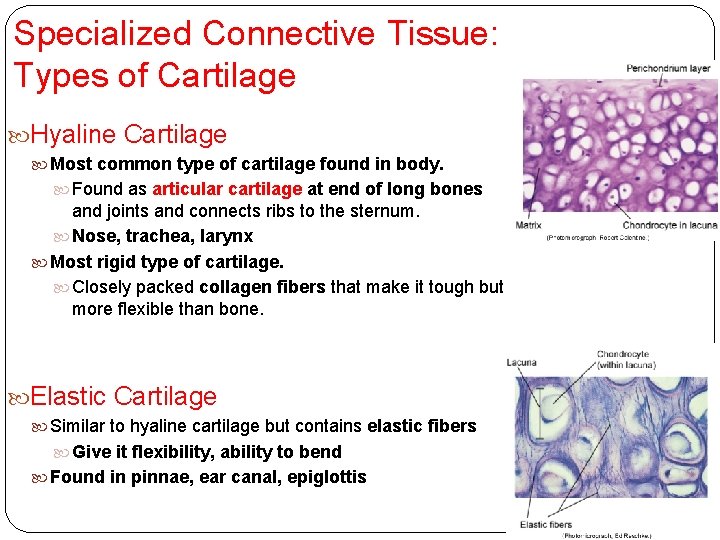 Specialized Connective Tissue: Types of Cartilage Hyaline Cartilage Most common type of cartilage found