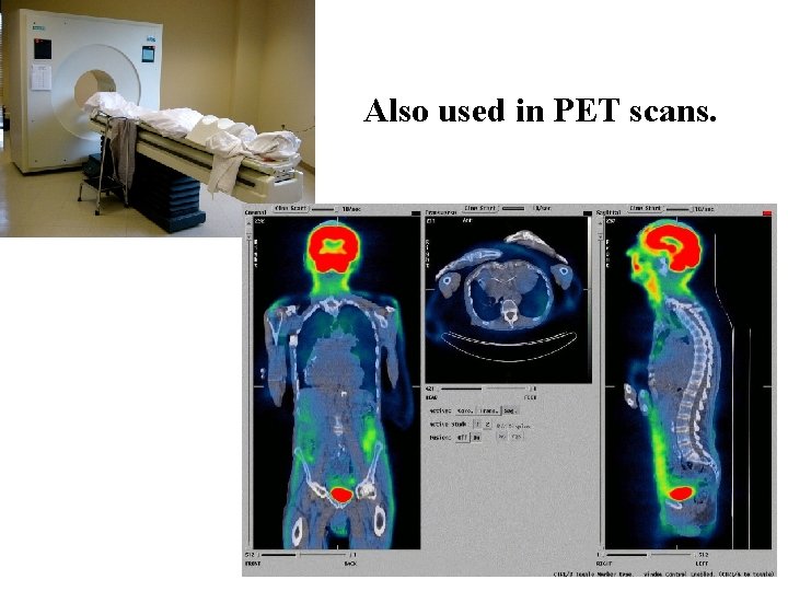 Also used in PET scans. 
