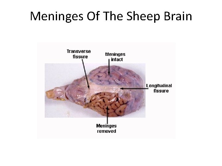 Meninges Of The Sheep Brain 