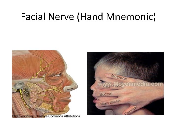 Facial Nerve (Hand Mnemonic) 