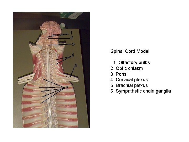 Spinal Cord Model 1. Olfactory bulbs 2. Optic chiasm 3. Pons 4. Cervical plexus