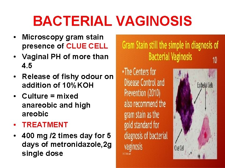 BACTERIAL VAGINOSIS • Microscopy gram stain presence of CLUE CELL • Vaginal PH of