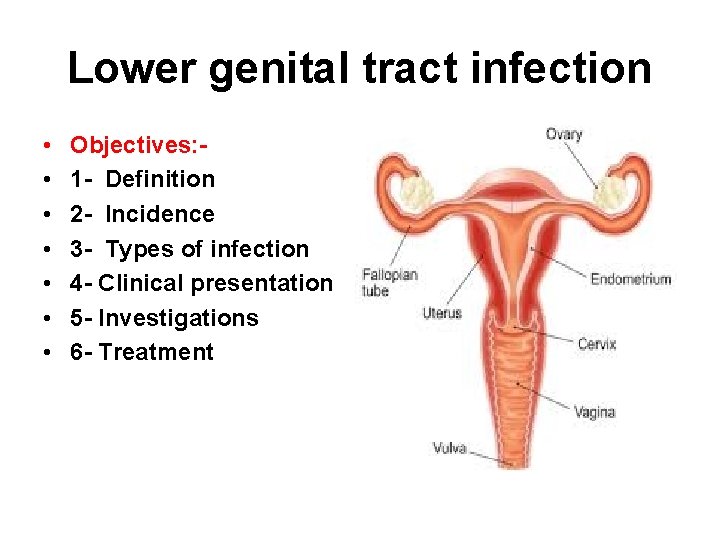 Lower genital tract infection • • Objectives: 1 - Definition 2 - Incidence 3