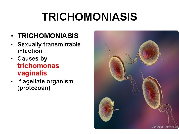 TRICHOMONIASIS • Sexually transmittable infection • Causes by trichomonas vaginalis • flagellate organism (protozoan)