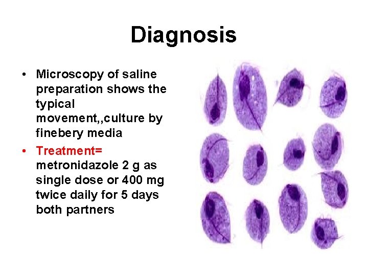 Diagnosis • Microscopy of saline preparation shows the typical movement, , culture by finebery
