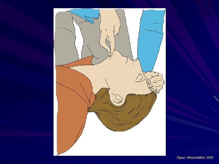Figuur: Resuscitation 2005 