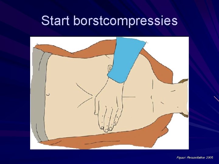 Start borstcompressies Figuur: Resuscitation 2005 