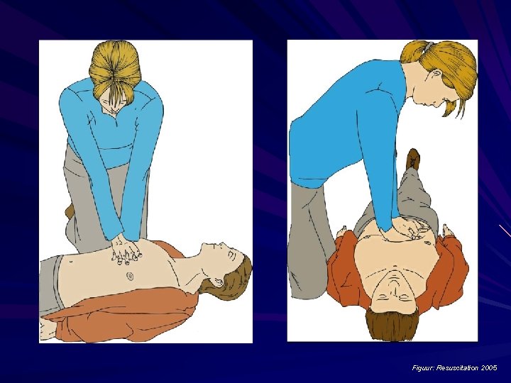Figuur: Resuscitation 2005 