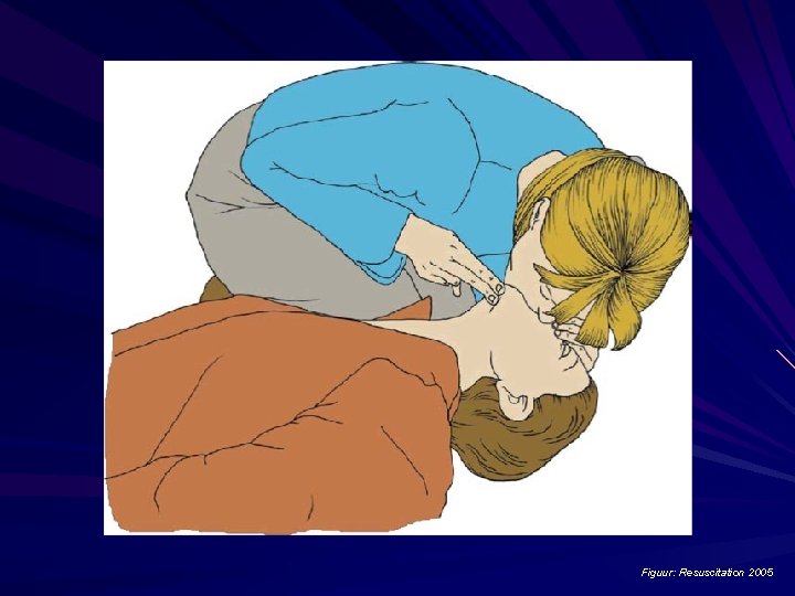 Figuur: Resuscitation 2005 