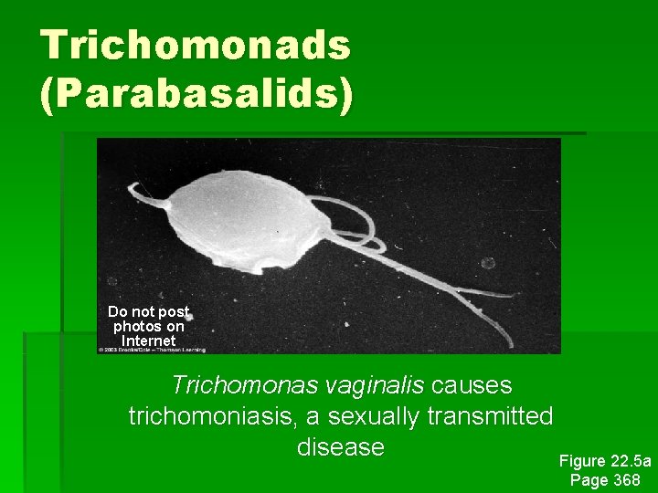 Trichomonads (Parabasalids) Do not post photos on Internet Trichomonas vaginalis causes trichomoniasis, a sexually