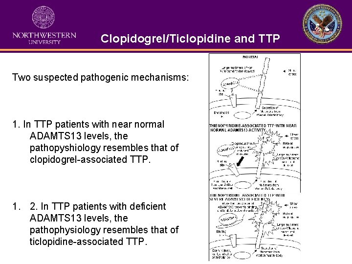 Clopidogrel/Ticlopidine and TTP Two suspected pathogenic mechanisms: 1. In TTP patients with near normal