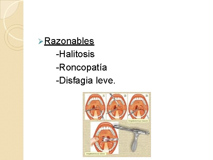 Ø Razonables -Halitosis -Roncopatía -Disfagia leve. 