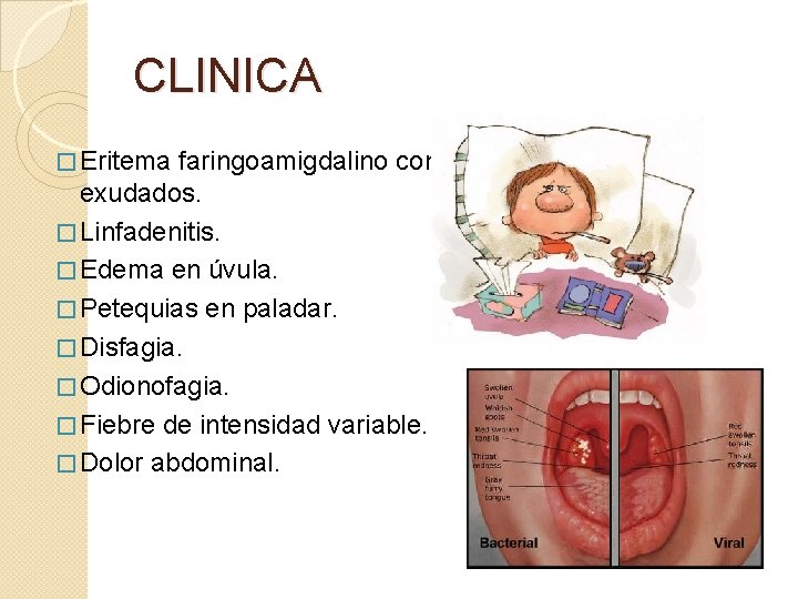 CLINICA � Eritema faringoamigdalino con o sin exudados. � Linfadenitis. � Edema en úvula.