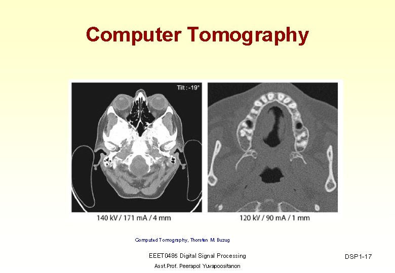 Computer Tomography Computed Tomography, Thorsten M. Buzug EEET 0485 Digital Signal Processing Asst. Prof.