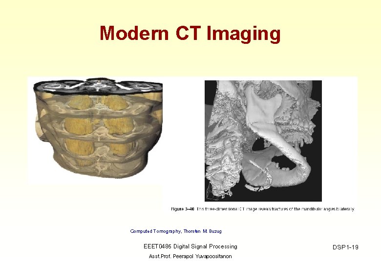 Modern CT Imaging Computed Tomography, Thorsten M. Buzug EEET 0485 Digital Signal Processing Asst.