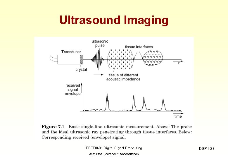 Ultrasound Imaging EEET 0485 Digital Signal Processing Asst. Prof. Peerapol Yuvapoositanon DSP 1 -23