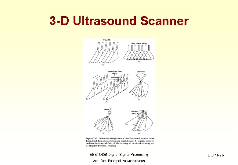 3 -D Ultrasound Scanner EEET 0485 Digital Signal Processing Asst. Prof. Peerapol Yuvapoositanon DSP