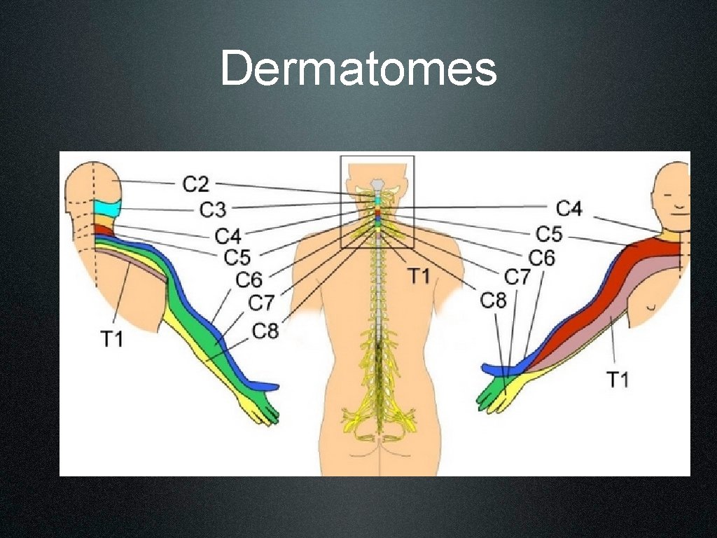 Dermatomes 