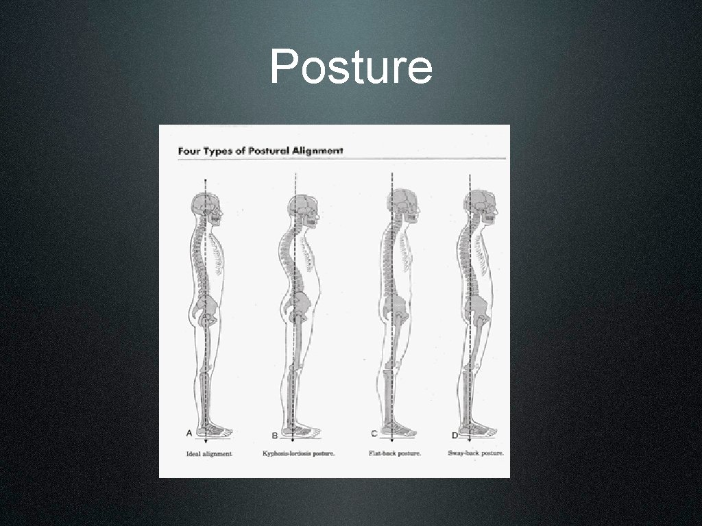 Posture 