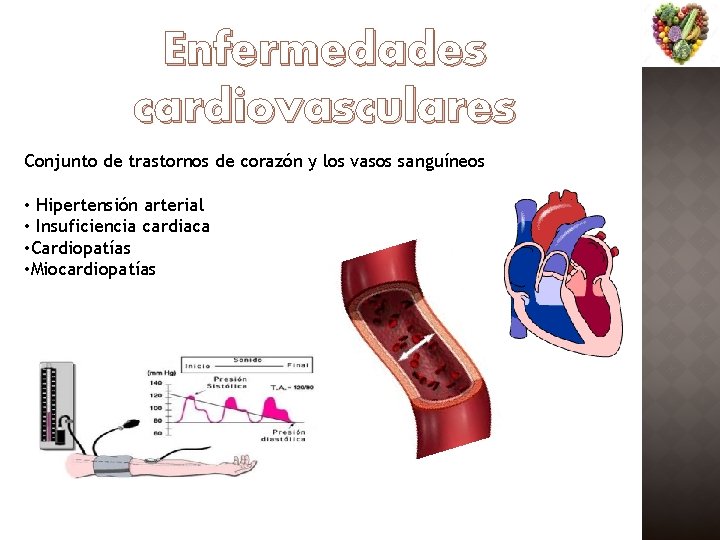 Enfermedades cardiovasculares Conjunto de trastornos de corazón y los vasos sanguíneos • Hipertensión arterial