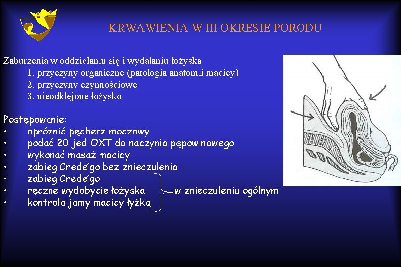 KRWAWIENIA W III OKRESIE PORODU Zaburzenia w oddzielaniu się i wydalaniu łożyska 1. przyczyny
